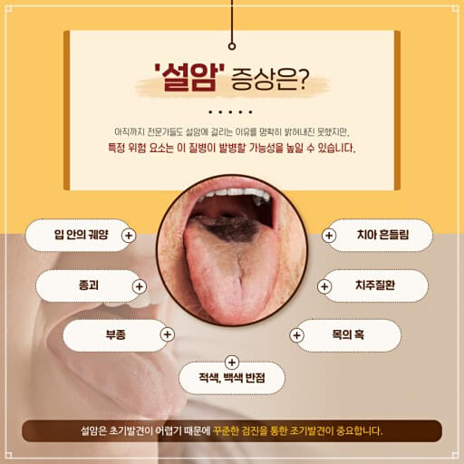 설암의 증상