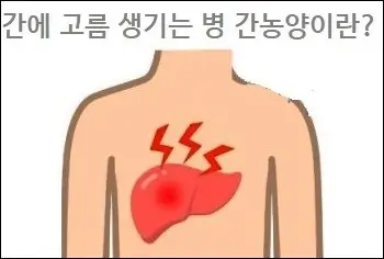 간에 고름 생기는 병 간농양이란
