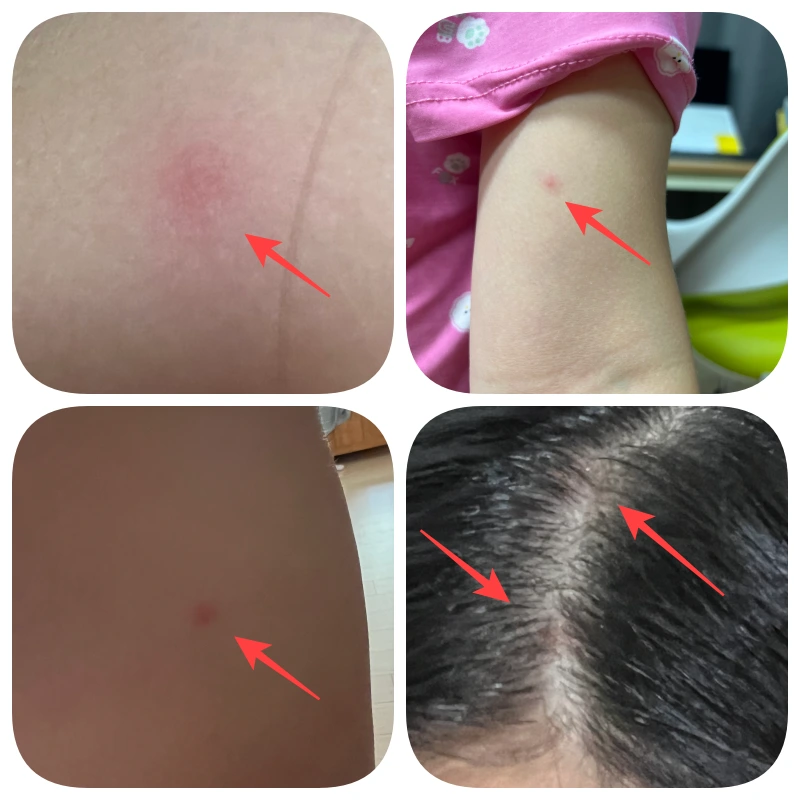 우리아이가 증상이 가장 심했을 때 사진 입니다.