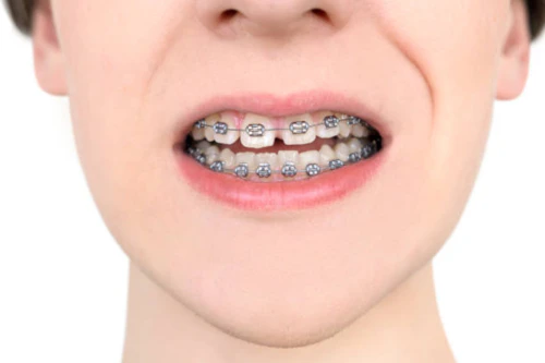 치과 교정비용 연말정산 8