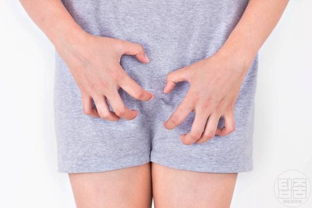 질염 증상,가려움증 따가움 화끈거림