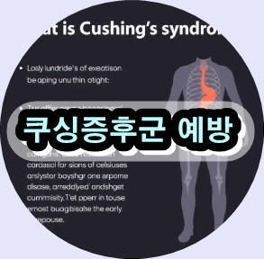 쿠싱증후군 치료법, 쿠싱증후군 원인, 쿠싱증후군 증상, 쿠싱증후군 진단 검사 , 쿠싱증후군 자연치료,코르티솔 과다 증상, 내분비 질환 치료 비용, 스테로이드 과다 부작용, 내분비내과 전문의 추천, 쿠싱증후군 관리 식단
