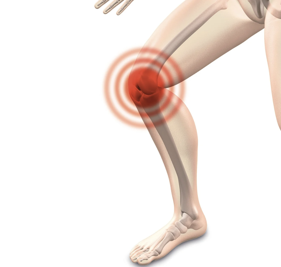 무릎 건강을 위한 운동
관절염 통증에 대한 이미지