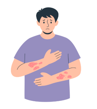 대상포진 예방접종 가격 무료 대상