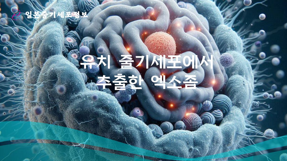 유치 줄기세포에서 추출한 엑소좀