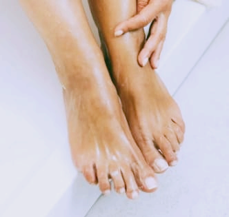 복숭아뼈 통증과 아래 통증&amp;#44; 골절일까?