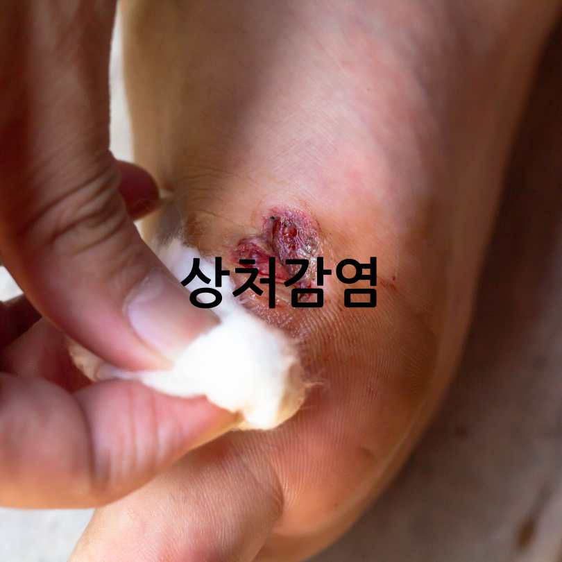 당뇨병 초기증상