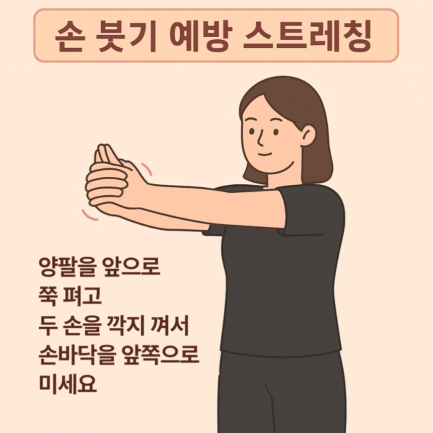 손 붓기 예방 스트레칭