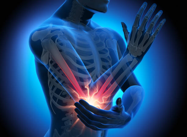 테니스 엘보우 엘보 치료 위치 보호대 원인 를 치료하려면 외측상과염 수술 스트레칭 운동 mri 체외충격파 골프 팔꿈치 근력 재활 염증 냉찜질