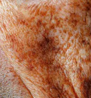 기미는 주로 여성에게 나타나는 색소 질환입니다.