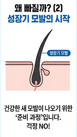 미녹시딜 부작용