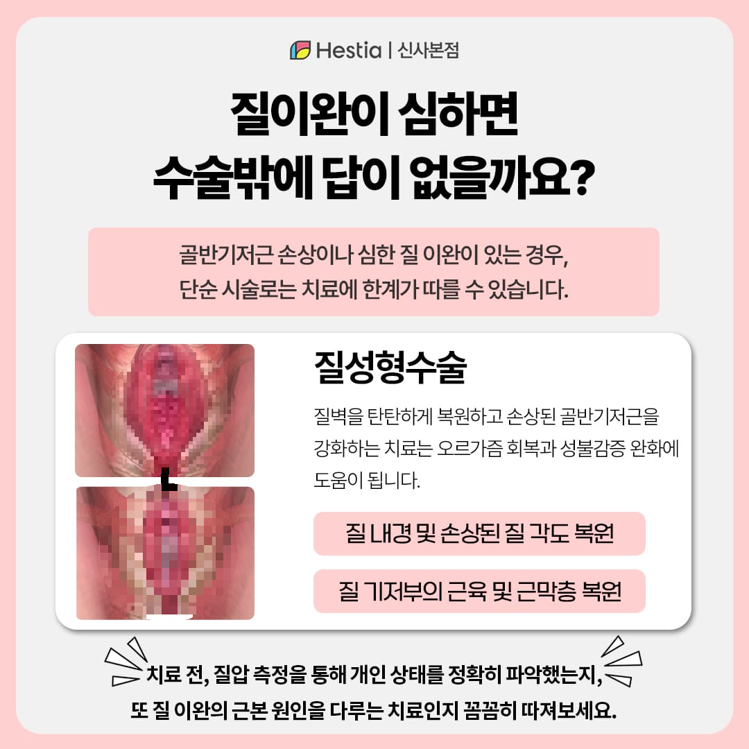 질이완이 심하다면, 질성형수술이 답일까요?