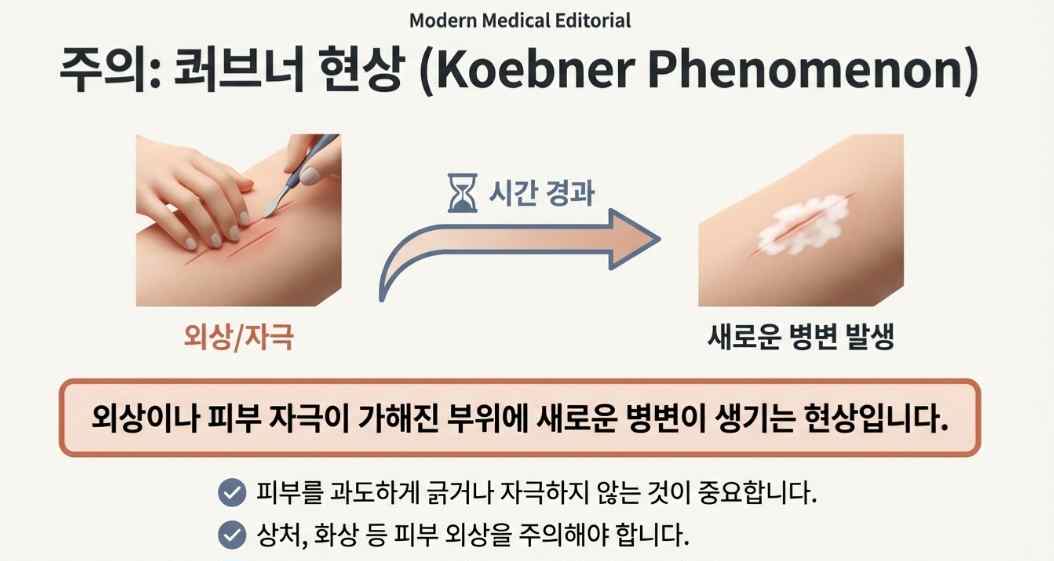 백반증원인-사진5