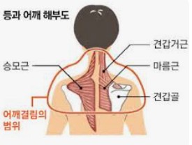 거북목 질병