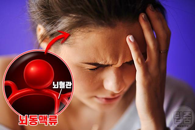 양파 효능,양파껍질 끓인물 효능,뇌졸중에 좋은 음식