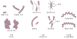 혐기성균 감염증을 일으키는 박테리아