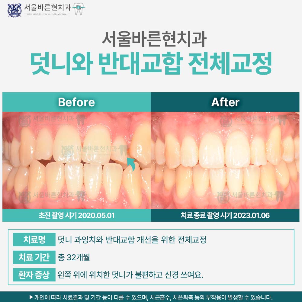 해운대교정치과