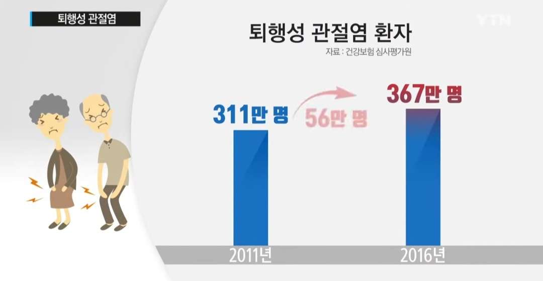 관절염 초기증상