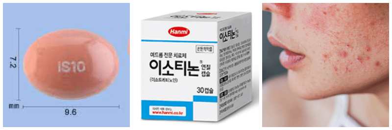 이소티논, 여드름 사진