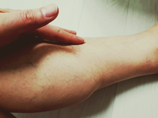 종아리-통증을-호소하는-사람