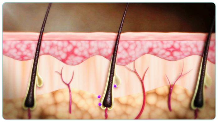 명의-탈모-과정
