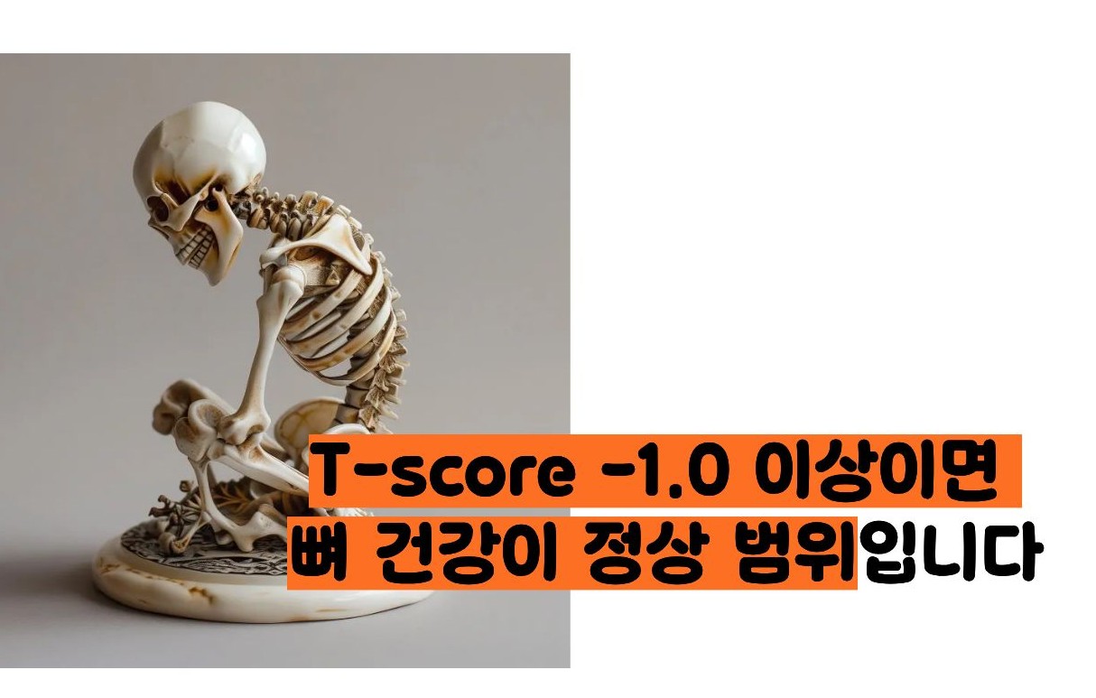 골밀도 정상수치