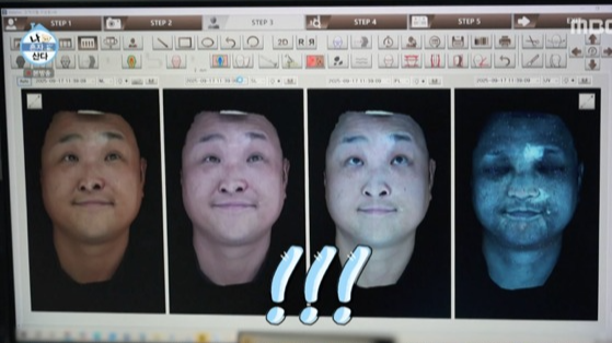  &lsquo;나 혼자 산다&rsquo; 구성환의 백반증 투병 이야기