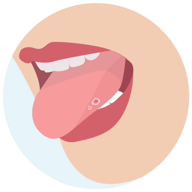 구내염 원인 10가지