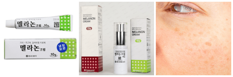 멜라논크림, 기미 사진