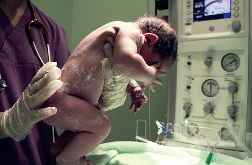 갈락토스혈증, 우유 먹으면 안 되는 병? 희귀 유전 질환(합병증 위험)