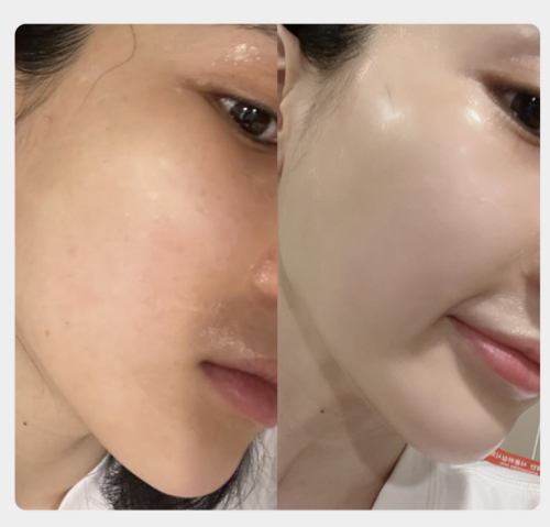 톰 프로그램(THOME) 후기