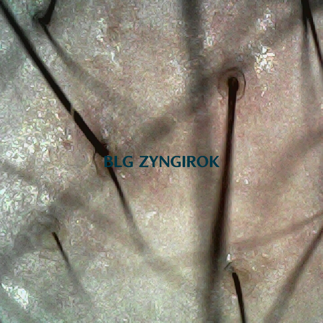 정수리와 이마 사이 두피 사진 모습이다.