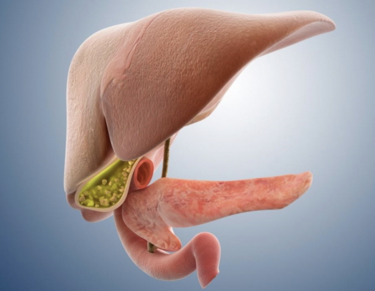 담성증 초기증상 정리