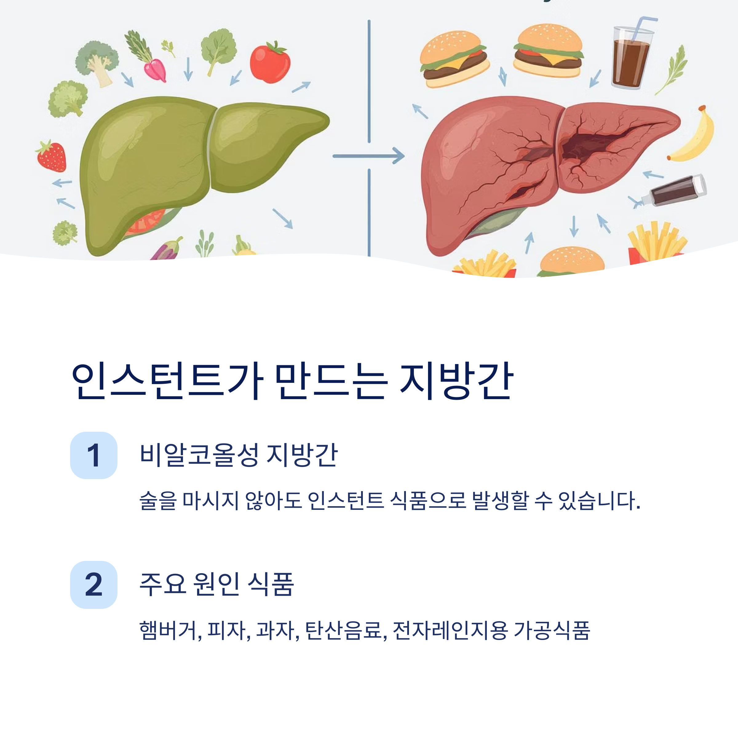 인스턴트 음식이 만든 지방간