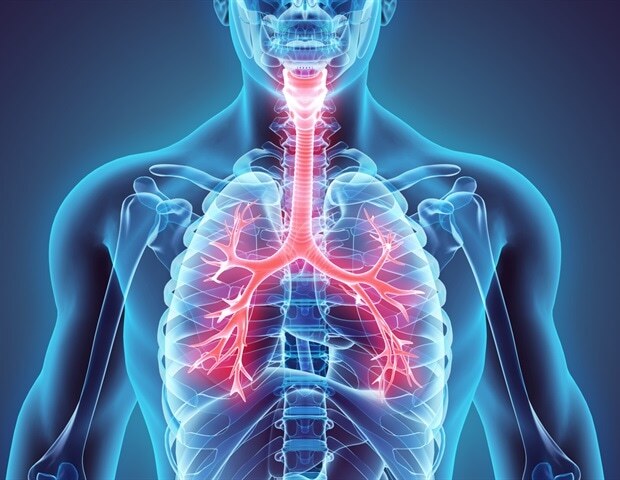 중증급성호흡기증후군