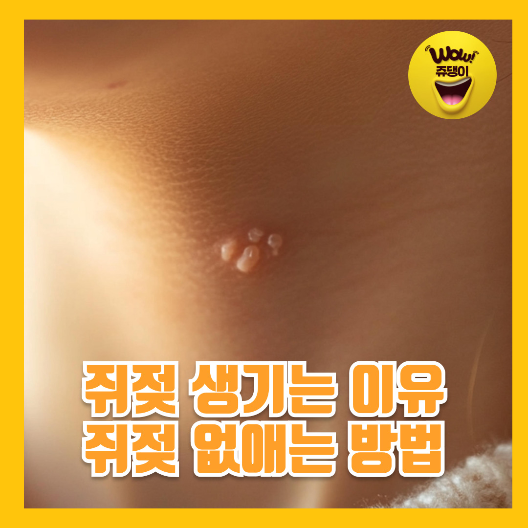 쥐젖 생기는 이유 와 쥐젖제거기 쥐젖 없애는 방법