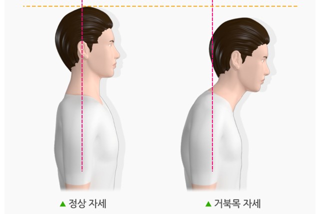 자세만 바꿨는데 목 통증이 줄었다! 쉽고 확실한 거북목 해결법