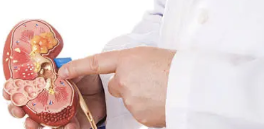 왼쪽 아랫배 통증 20