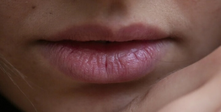 입술이 부르트는 이유 건조함