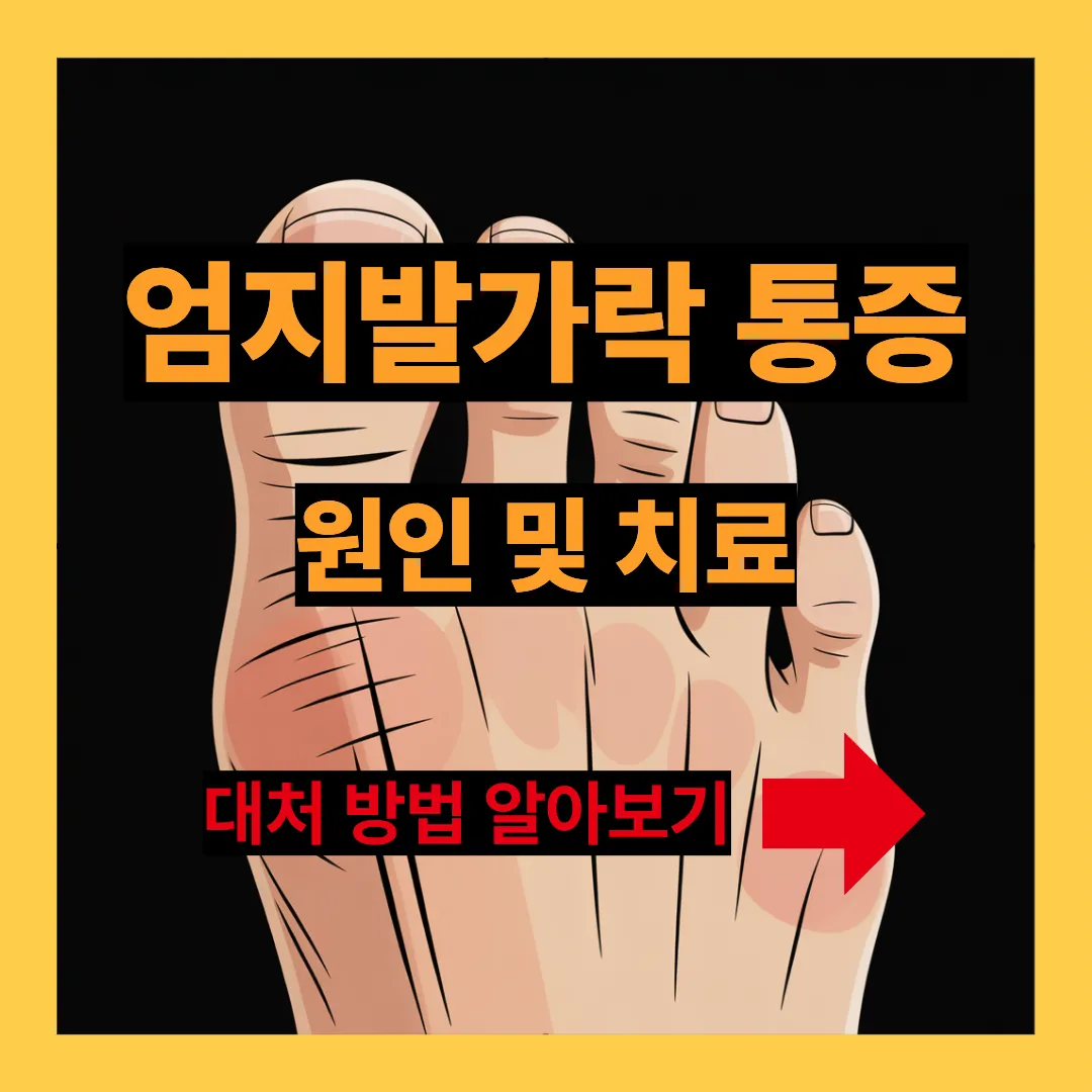 엄지발가락 통증 원인 및 치료 대처 방법 알아보기