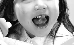 입안 염증이 생기는 이유