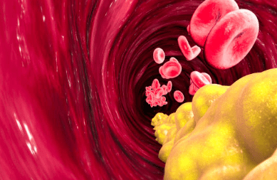 중성지방 낮추는 방법, 중성지방 정상수치