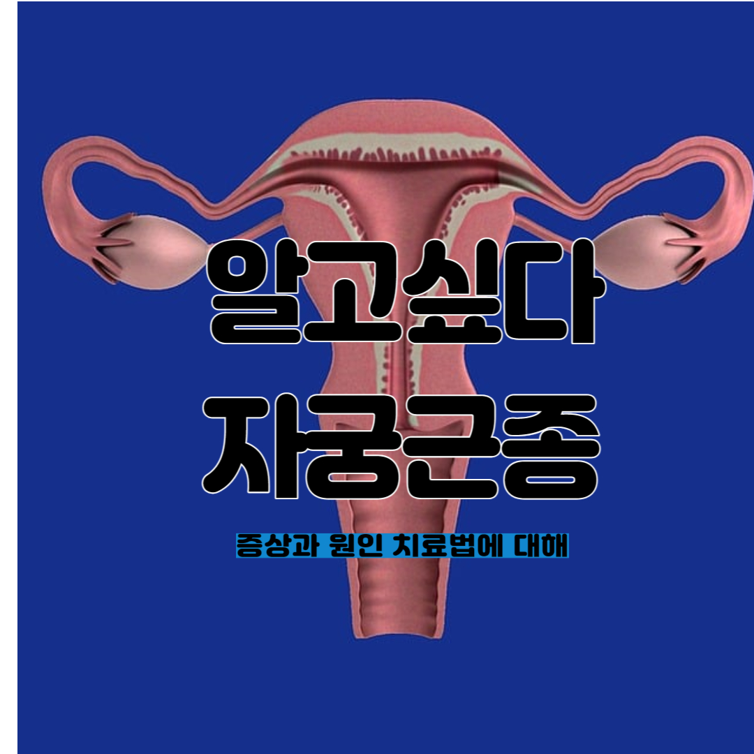 자궁근종-원인-증상-링크