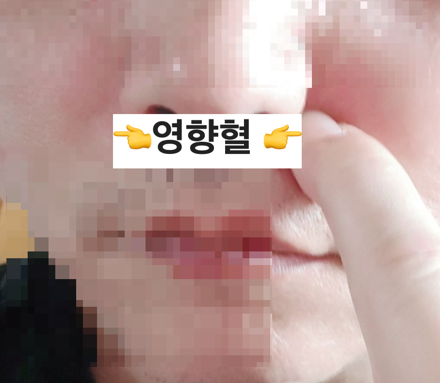 영향혈