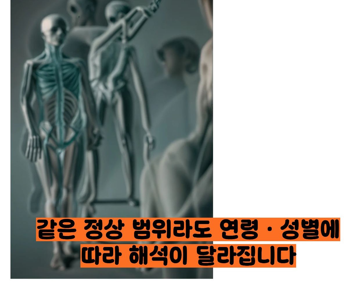 골밀도 정상수치