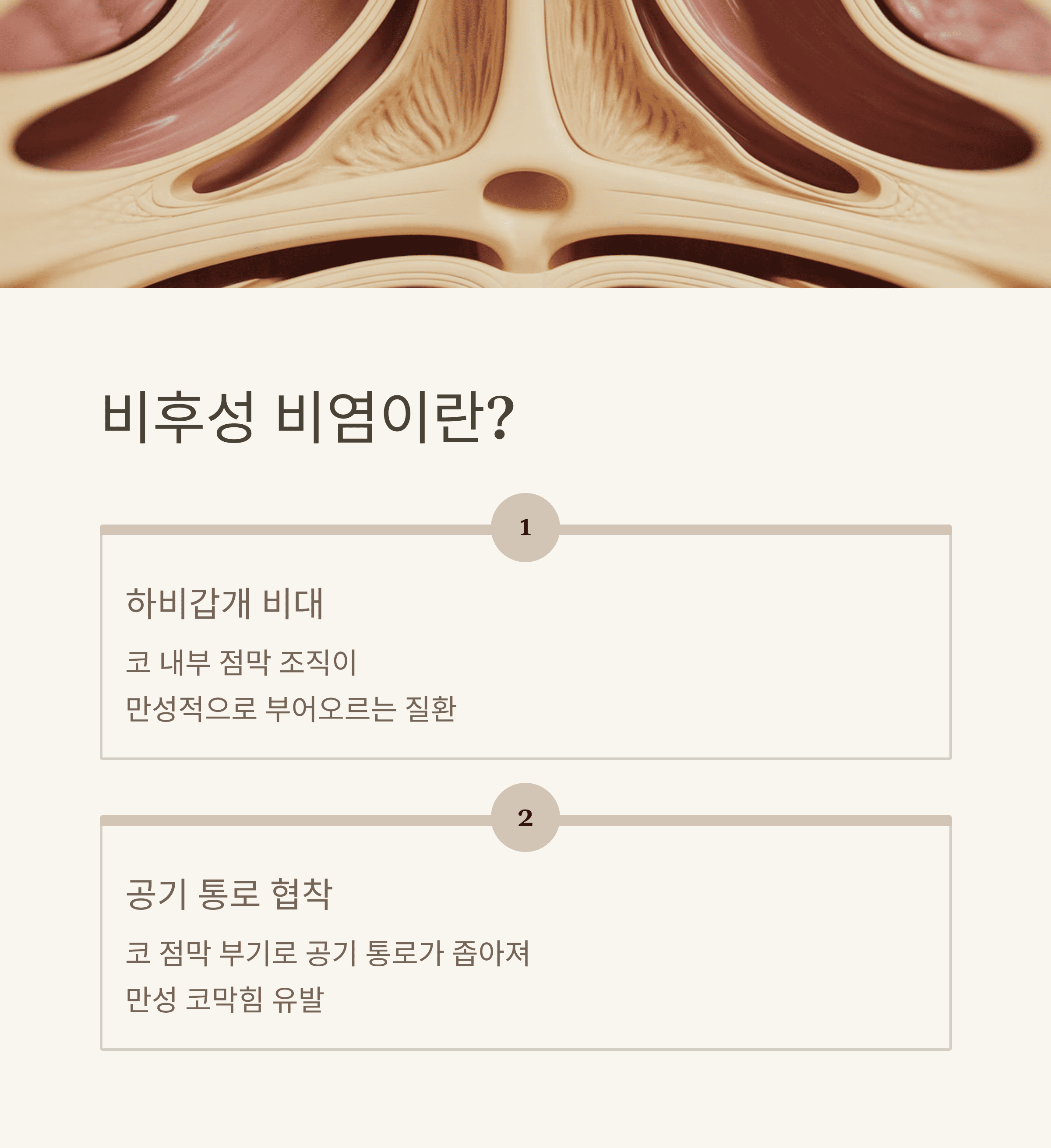 비후성 비염 증상과 효과적인 치료법 완벽 분석