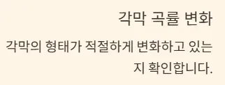 드림렌즈 착용기간 - 수명관리 - 각막 곡률 변화
