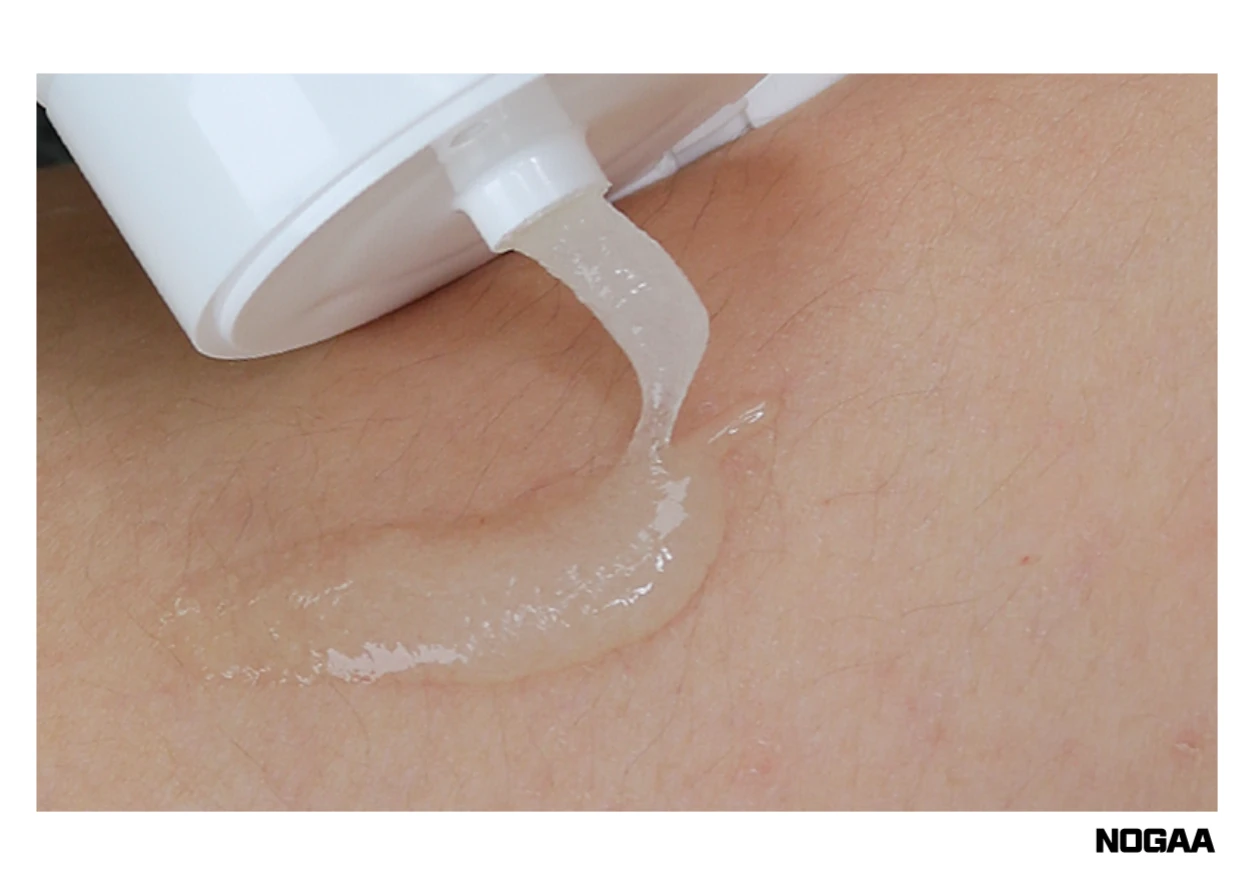 모공각화증 치료 방법