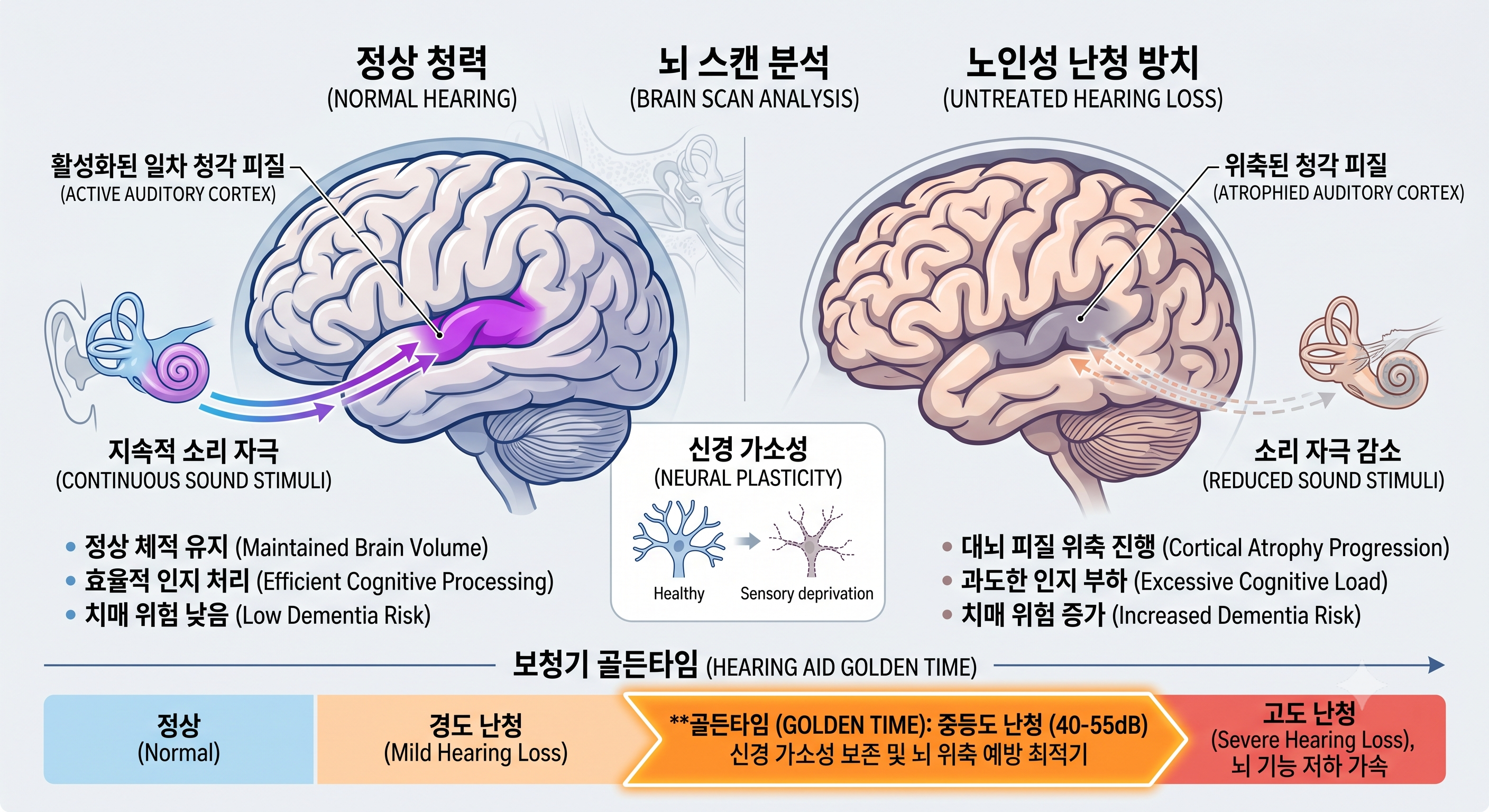노인성 난청과 대뇌 피질 위축의 상관관계 및 보청기 골든타임 분석