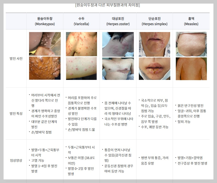 원숭이두창과피부질환의차이점